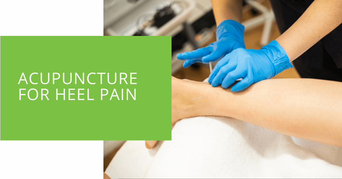 How Acupuncture Can Soothe Plantar Fasciitis In 4 Short Weeks