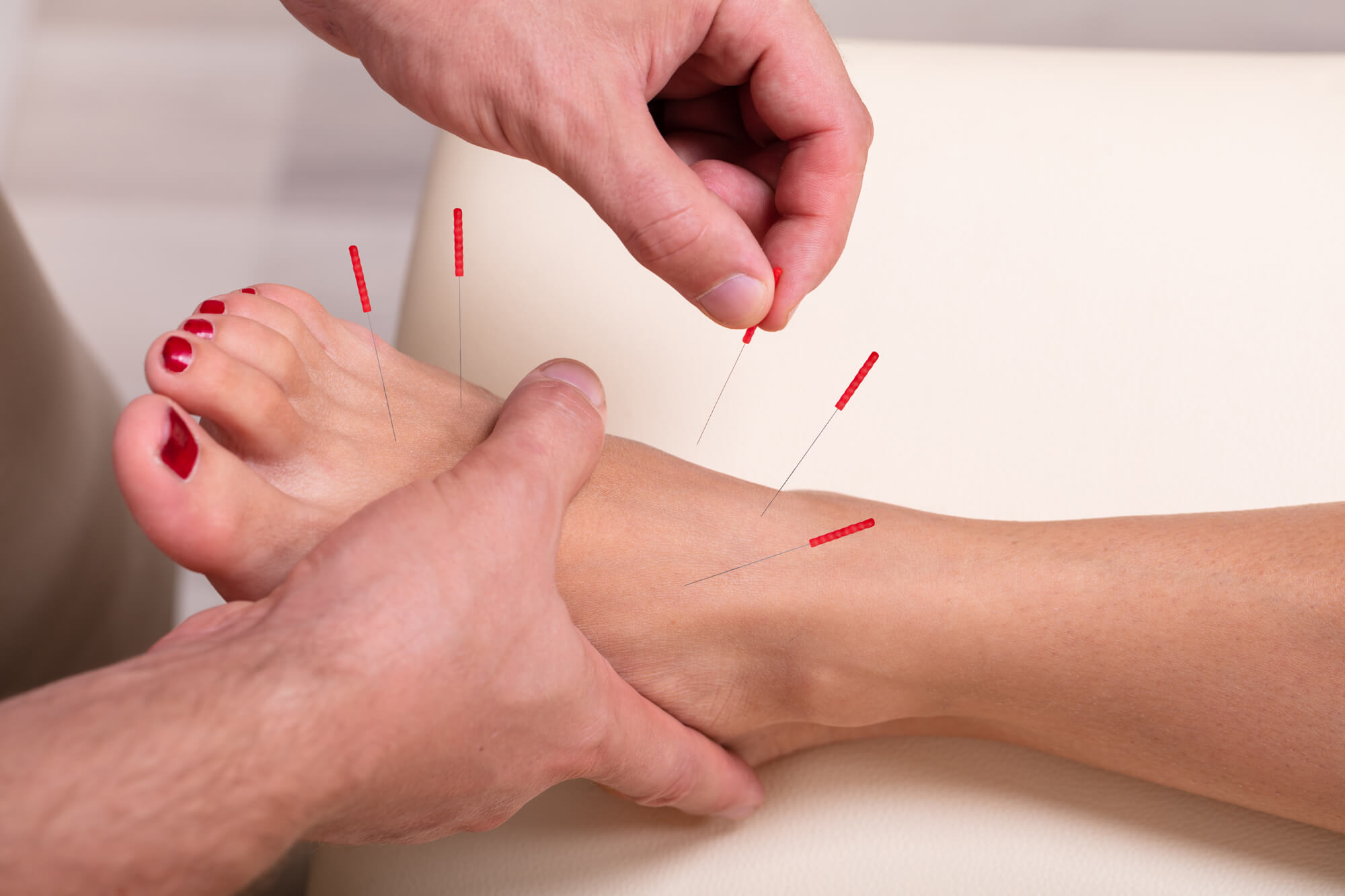 Foot Acupuncture