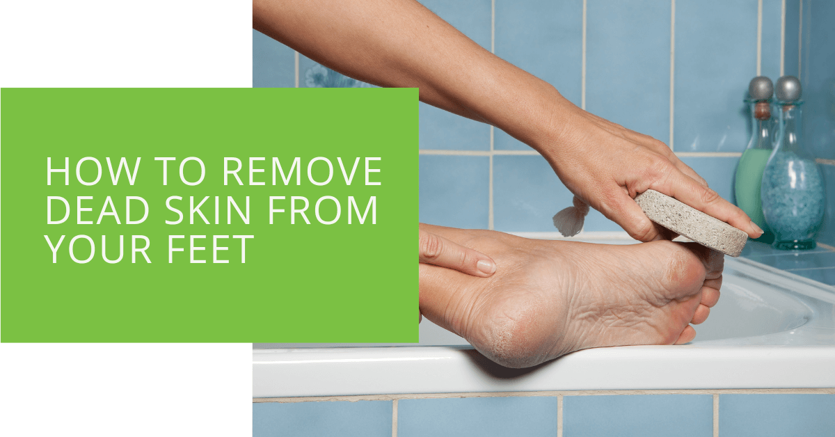 https://www.epodiatrists.com/wp-content/uploads/2023/03/How-to-Remove-Dead-Skin-from-Your-Feet.png