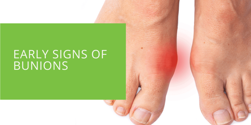 Early Signs of Bunions