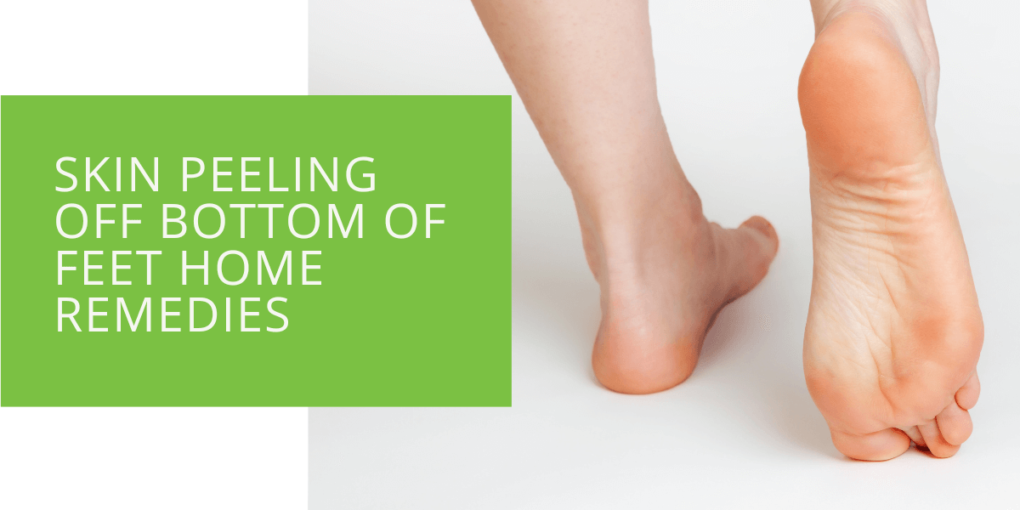 Peeling Feet: Amazing Remedies