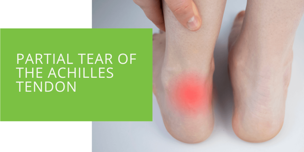 Partial Tear of the Achilles Tendon