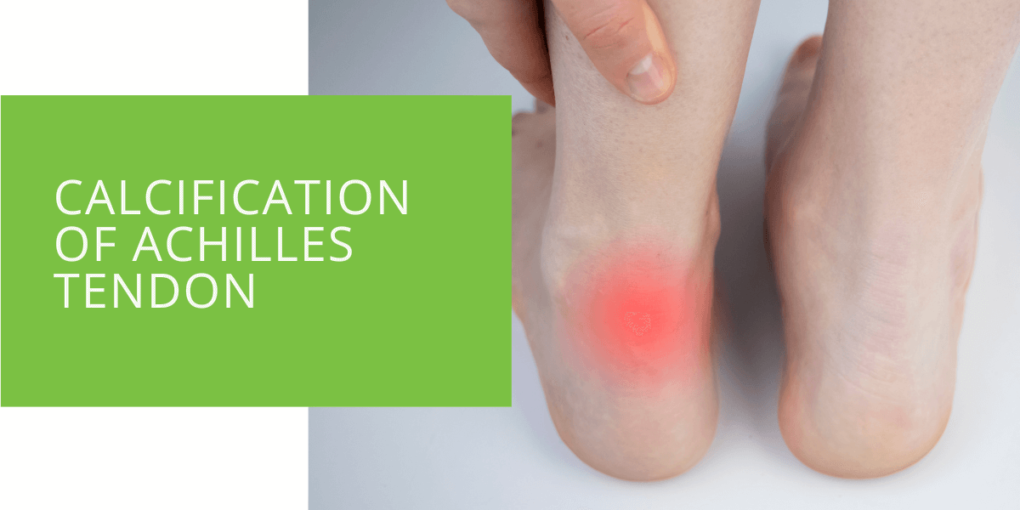 Calcification of Achilles Tendon